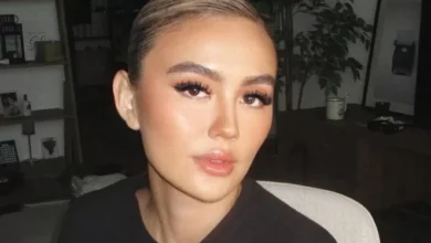 Mengenal Alopecia Areata, Penyakit yang dimaksud yang disebutkan Menjangkit Agnez Mo hingga Alami Kebotakan