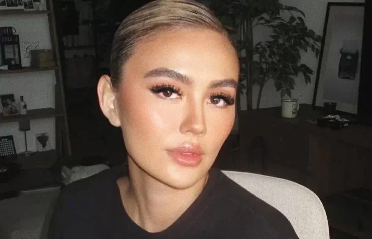 Mengenal Alopecia Areata, Penyakit yang dimaksud yang disebutkan Menjangkit Agnez Mo hingga Alami Kebotakan