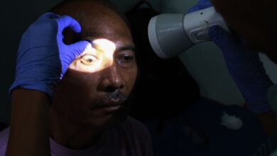 8 pemicu mata belekan sesudah itu cara alami mengobatinya